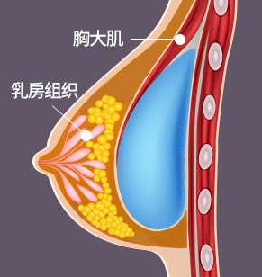 胸大肌 乳房组织