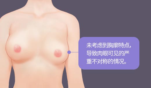 未考虑到胸廓特点，导致肉眼可见的严重不对称的情况。
