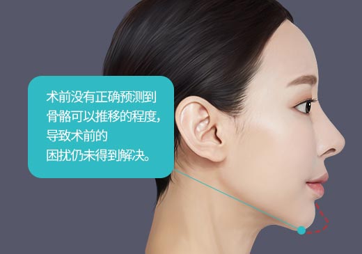 术前没有正确预测到骨骼可以推移的程度,导致术前的困扰仍未得到解决。