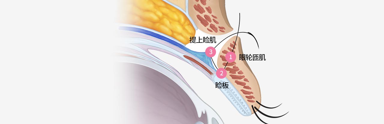 01 眼轮匝肌, 02 睑板, 03 提上睑肌