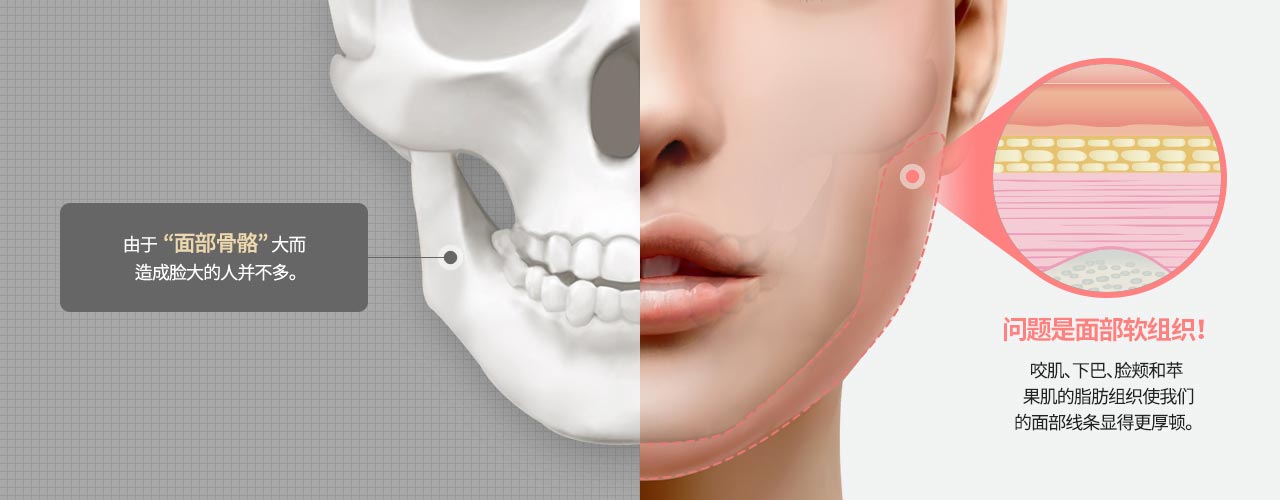 由于“面部骨骼”大而 造成脸大的人并不多。,问题是面部软组织！咬肌、下巴、脸颊和苹果肌的脂肪组织使我们的面部线条显得更厚顿。